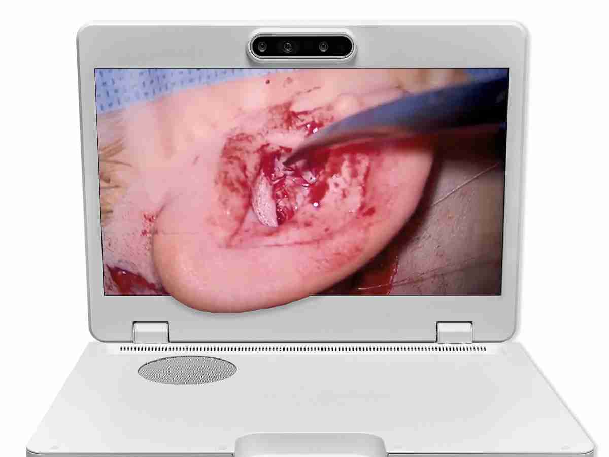 达擎之＂Heads-up 3D显微手术显示系统＂，，，整合4K裸眼3D显示及眼球追踪系统，，，，具备快速追踪人眼移动位置功能，，减轻医师长时间维持固定姿势的负担，，让医师能有更宽广清晰的3D立体视野及更舒适的姿势来执行手术。。。。